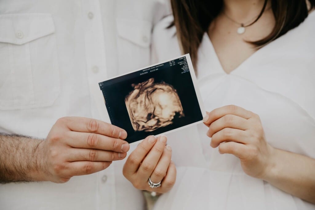 couple holding ultrasound picture of baby